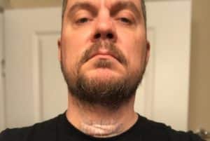 Mark Hunter de Chimaira déclare que la chirurgie pour son cancer a été un succès