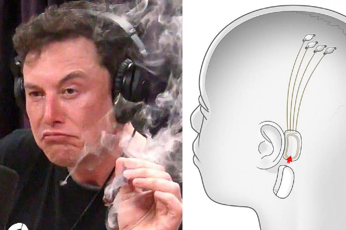 Elon Musk dit que Neuralink pourra diffuser de la musique directement dans le cerveau