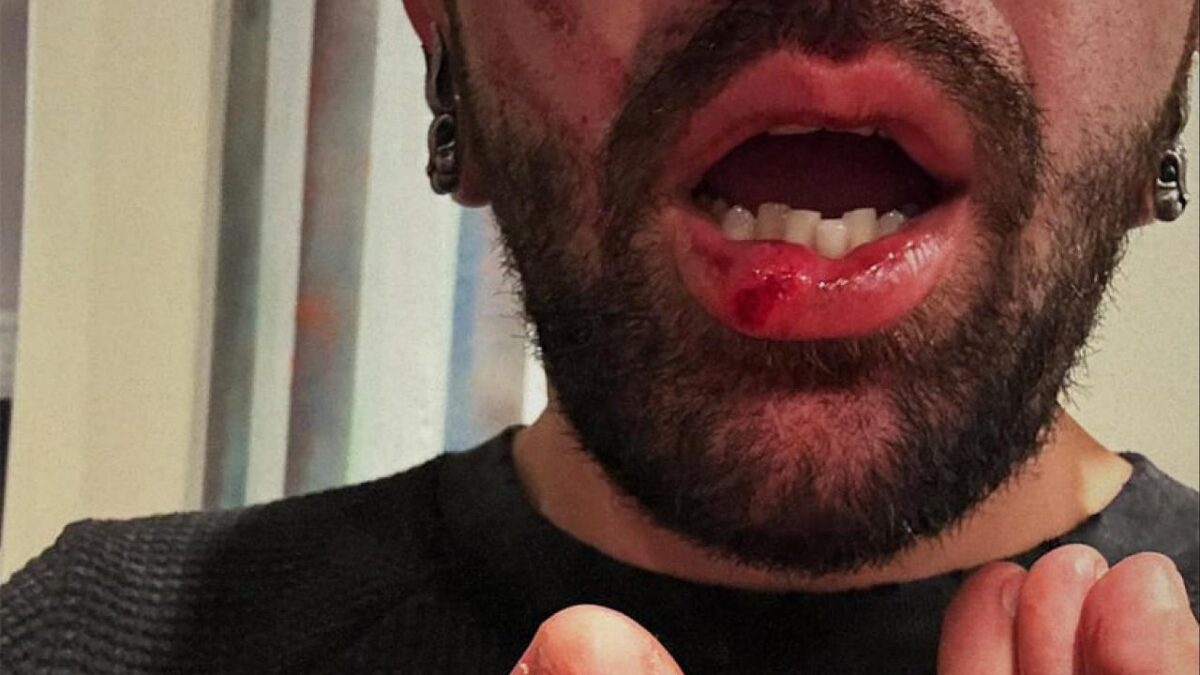 Scène de violence à Chicago : Le chanteur de The Bunny The Bear défend sa femme après une agression lors d&rsquo;un concert